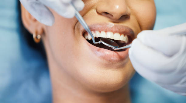 Best Walk-In Emergency Dentist in Vashon, WA